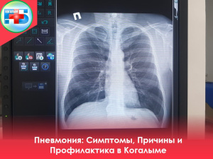   В Когалыме на 21 ноября зарегистрировано 75 случаев вирусных пневмоний, из которых 33 — у детей. В стационаре находятся 6 пациентов, остальные лечатся амбулаторно. 