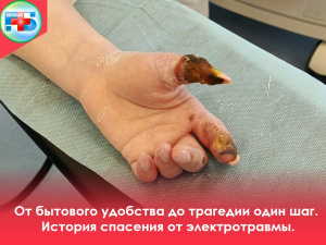 От бытового удобства до трагедии один шаг.  История спасения от электротравмы