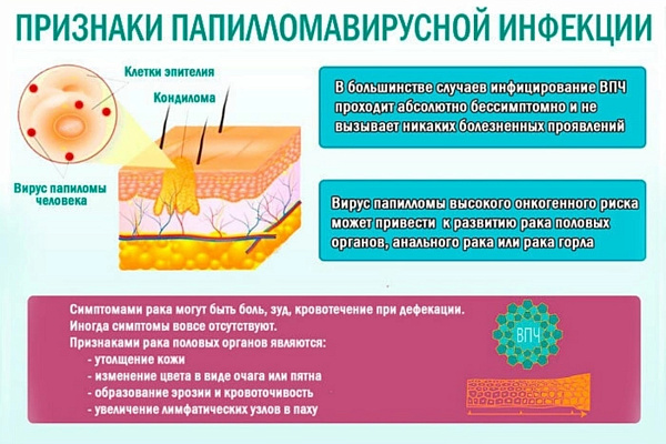 ВИРУС ПАПИЛЛОМЫ ЧЕЛОВЕКА — одно из самых распространенных инфекционных заболеваний в мире