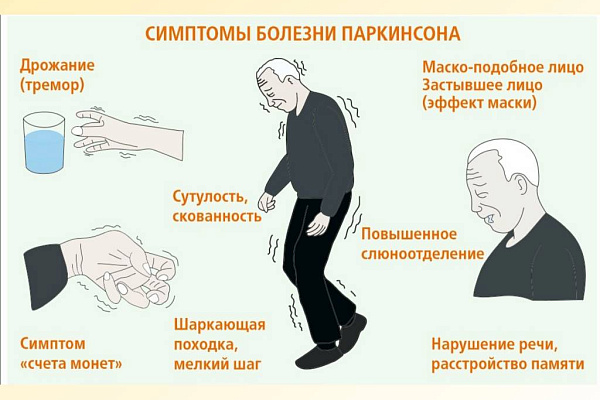 Проблема борьбы с болезнью Паркинсона носит всемирный характер