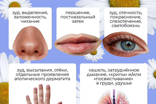 Аллергия